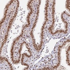 Anti-MEPCE Antibody