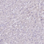 Anti-PPP1R35 Antibody