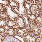 Anti-C17orf98 Antibody