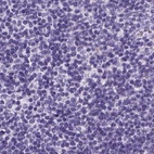 Anti-PDIA2 Antibody