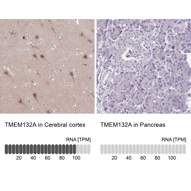 Anti-TMEM132A Antibody