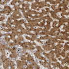 Anti-PSMB7 Antibody