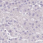 Anti-PDIA2 Antibody