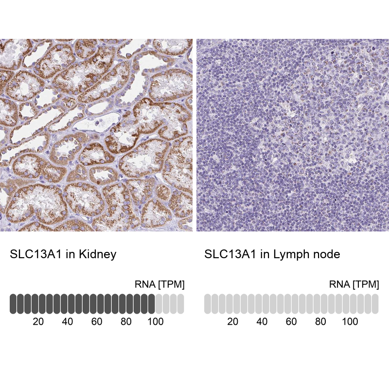 Anti-SLC13A1 Antibody