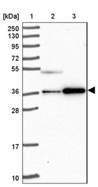 Anti-CCDC137 Antibody