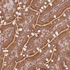 Anti-MRPL16 Antibody