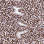 Anti-CREBBP Antibody