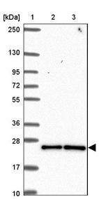 Anti-CCDC12 Antibody