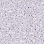 Anti-PYCR2 Antibody