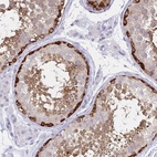 Anti-TOMM34 Antibody