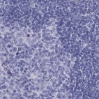 Anti-PSMB11 Antibody