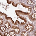 Anti-CCDC130 Antibody
