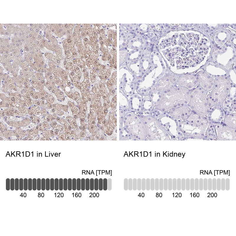 Anti-AKR1D1 Antibody