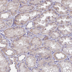 Anti-ABHD16A Antibody