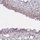 Anti-SLC14A1 Antibody