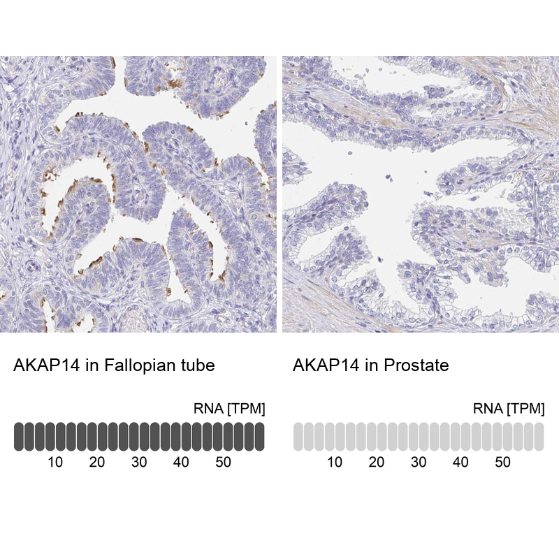 Anti-AKAP14 Antibody
