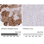 Anti-ATP2A2 Antibody