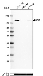 Anti-BRIP1 Antibody