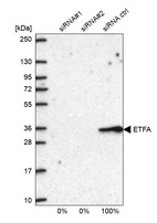 Anti-ETFA Antibody