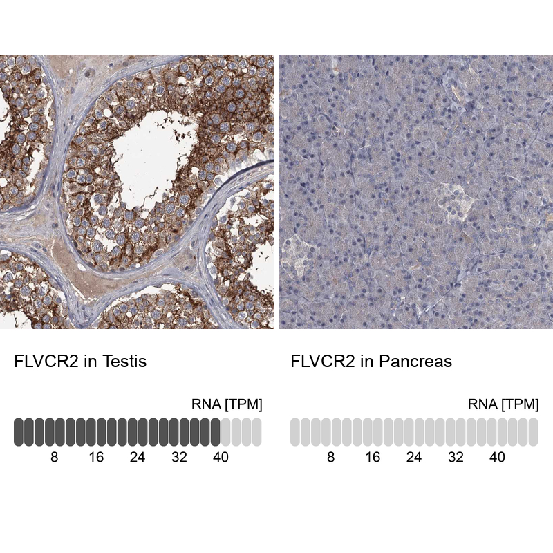 Anti-FLVCR2 Antibody