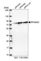 Anti-RPS6KB1 Antibody