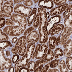 Anti-MPC1 Antibody