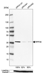 Anti-RPP38 Antibody