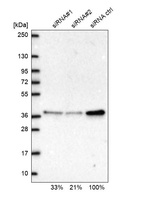 Anti-RPP38 Antibody