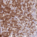 Anti-RPL18 Antibody