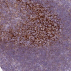Anti-CR1 Antibody