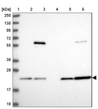 Anti-PSMB8 Antibody