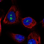 Anti-LRRC23 Antibody