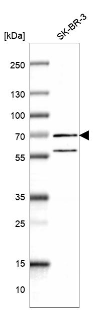 Anti-RNF6 Antibody