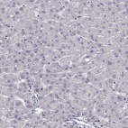 Anti-TSPYL5 Antibody