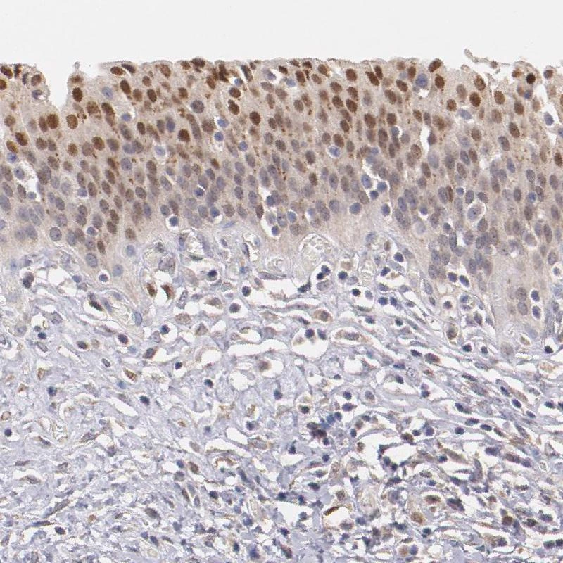 Anti-ATF3 Human Protein Atlas Antibody