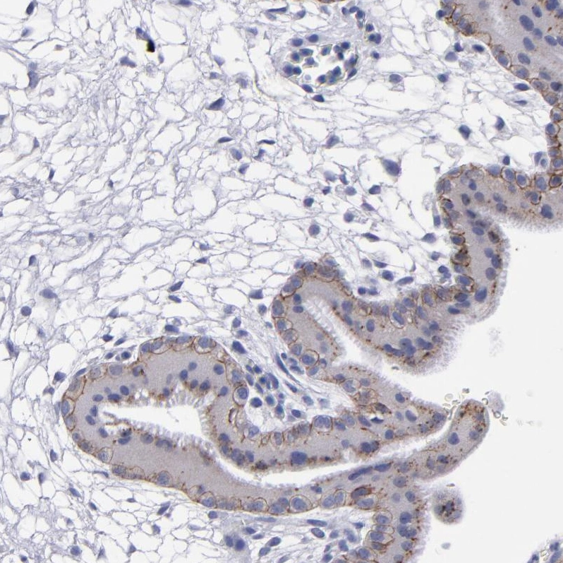 Rabbit Polyclonal Anti-CDH3 Antibody - Buy for research - Highly ...