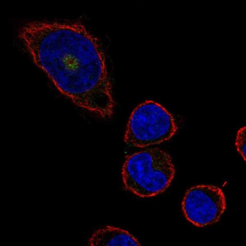 Rabbit Polyclonal Anti-CD36 Antibody - Buy for research