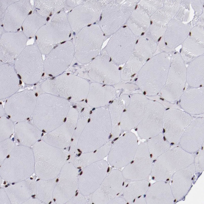 Rabbit Polyclonal Anti-APEX1 Antibody - Buy for research