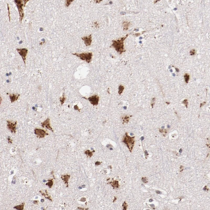 Anti-BEGAIN Human Protein Atlas Antibody