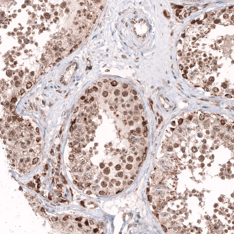 Anti-AFF2 Human Protein Atlas Antibody