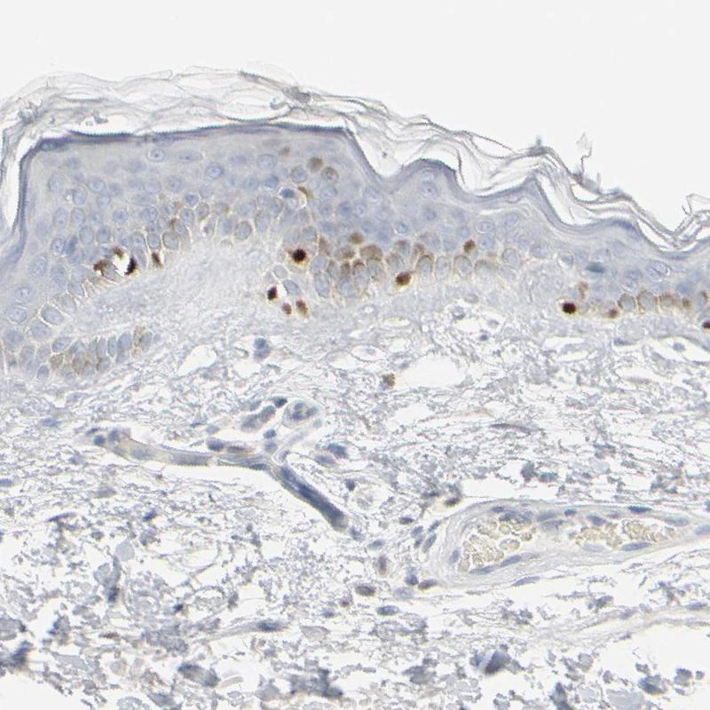Anti-MITF Human Protein Atlas Antibody