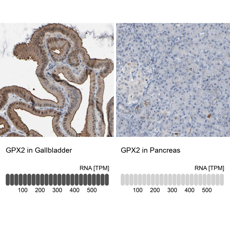 glutathione peroxidase 2/gpx2 antibody Glutathione Peroxidase 2/GPX2 Antibody, Novus