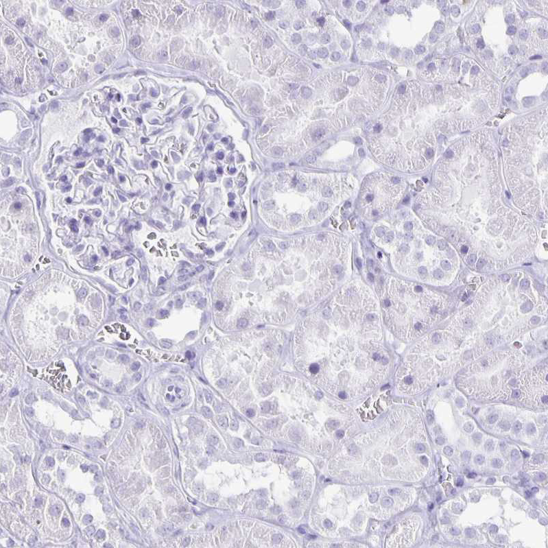 Rabbit Polyclonal Anti-CXorf67 Antibody - Buy for research