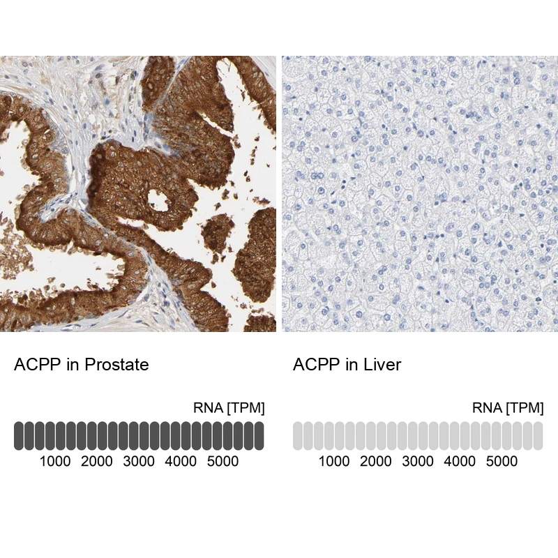 Anti-ACPP Human Protein Atlas Antibody