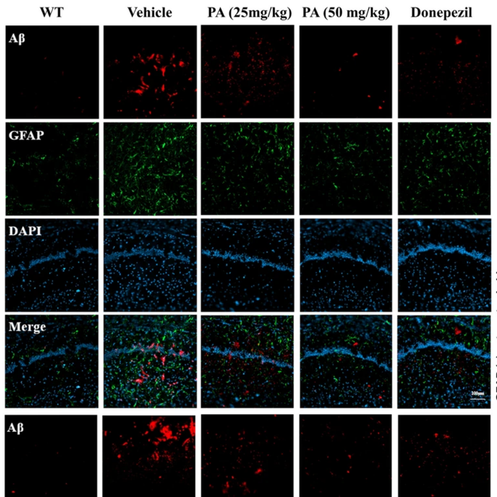 TripleA Polyclonal anti-GFAP in Alzheimer’s disease study