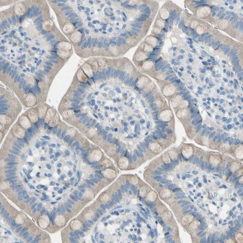 Anti-ATRN Human Protein Atlas Antibody