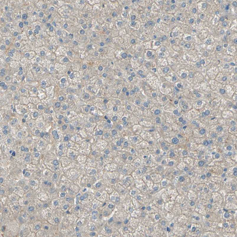 Anti-ATRN Human Protein Atlas Antibody