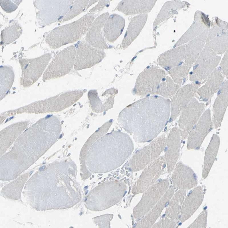 Anti-ATRN Human Protein Atlas Antibody