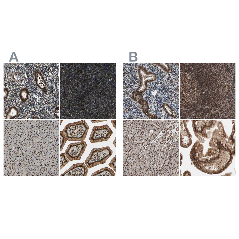 Rabbit Polyclonal Anti-CHAMP1 Antibody - Buy for research