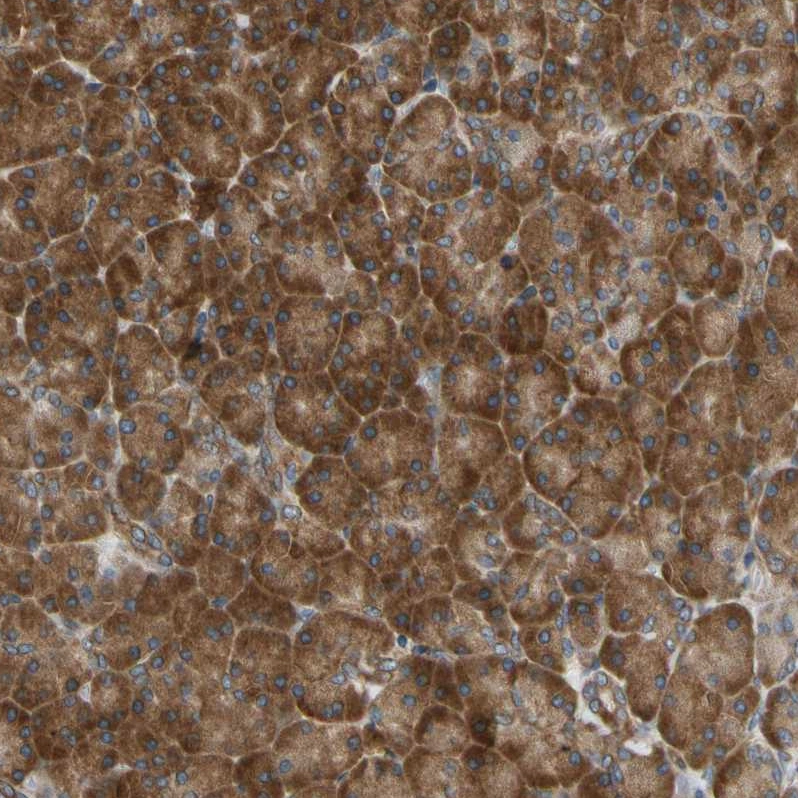 Anti-VAPA Human Protein Atlas Antibody Anti-VAPA Human Protein Atlas Antibody